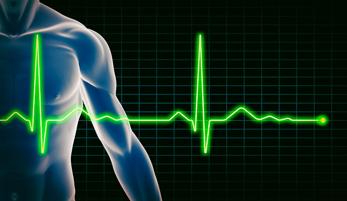Cardio Revolution: Part III